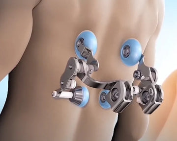 Quad Style Rollers